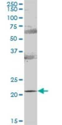 Western Blot: RAB31 Antibody [H00011031-B01P] - Analysis of RAB31 expression in human colon.