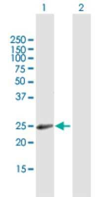 Western Blot: RAB31 Antibody [H00011031-B01P] - Analysis of RAB31 expression in transfected 293T cell line by RAB31 polyclonal antibody.  Lane 1: RAB31 transfected lysate(21.45 KDa). Lane 2: Non-transfected lysate.