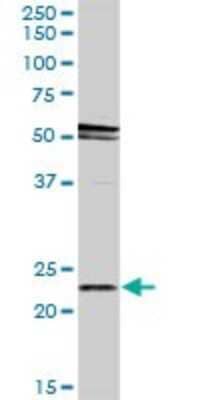 Western Blot: RAB31 Antibody [H00011031-D01P] - Analysis of RAB31 expression in human placenta.