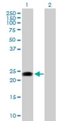 Western Blot: RAB31 Antibody [H00011031-D01P] - Analysis of RAB31 expression in transfected 293T cell line by RAB31 polyclonal antibody.Lane 1: RAB31 transfected lysate(21.45 KDa).Lane 2: Non-transfected lysate.