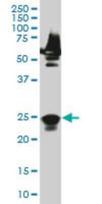 Western Blot RAB33A Antibody (8A11)