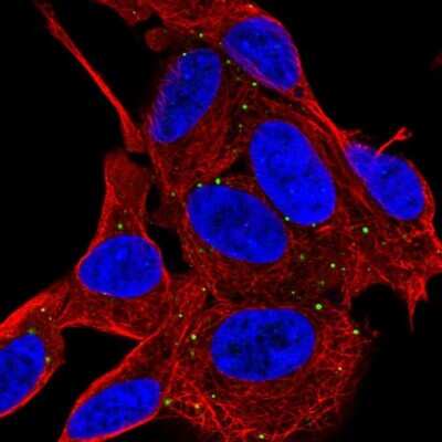 Immunocytochemistry/Immunofluorescence: RAB33A Antibody [NBP2-31793] - Staining of human cell line SH-SY5Y shows localization to vesicles. Antibody staining is shown in green.