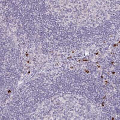 Immunohistochemistry-Paraffin: RAB33A Antibody [NBP2-31793] - Staining of human lymph node shows strong cytoplasmic positivity in a subset of lymphoid cells.