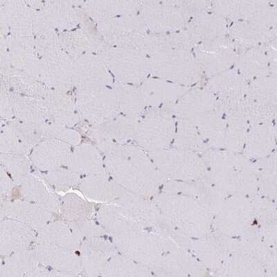 Immunohistochemistry-Paraffin: RAB33A Antibody [NBP2-31793] - Staining of human skeletal muscle shows no positivity in myocytes as expected.