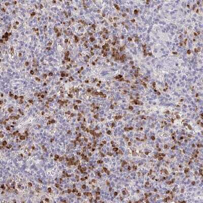 Immunohistochemistry-Paraffin: RAB33A Antibody [NBP2-31793] - Staining of human spleen shows strong cytoplasmic positivity in cells in red pulp.