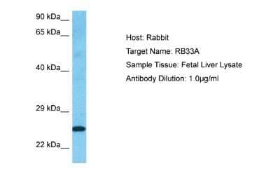 Western Blot: RAB33A Antibody [NBP2-85574] - Host: Rabbit. Target Name: RB33A. Sample Type: Fetal Liver lysates. Antibody Dilution: 1.0ug/ml