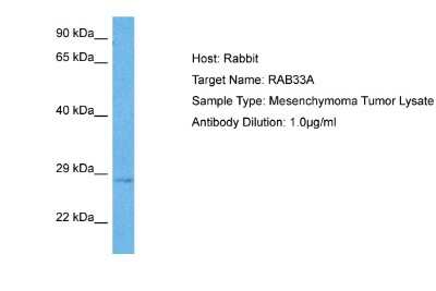 Western Blot: RAB33A Antibody [NBP2-85575] - Host: Rabbit. Target Name: RAB33A. Sample Tissue: Human Mesenchymoma Tumor lysates. Antibody Dilution: 1ug/ml