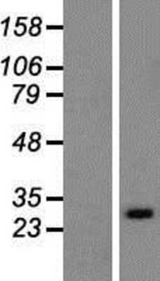 Western Blot RAB33A Overexpression Lysate