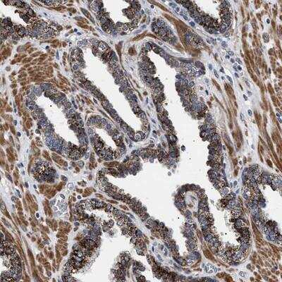 Immunohistochemistry: RAB34 Antibody [NBP1-87177] - Staining of human prostate shows strong positivity in glandular cells.