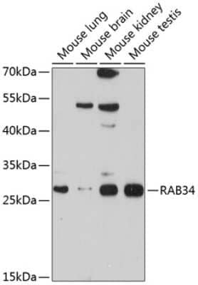 Western Blot: RAB34 Antibody [NBP2-93447] - Analysis of extracts of various cell lines, using RAB34 at 1:1000 dilution. Secondary antibody: HRP Goat Anti-Rabbit IgG (H+L) at 1:10000 dilution. Lysates/proteins: 25ug per lane. Blocking buffer: 3% nonfat dry milk in TBST. Detection: ECL Basic Kit . Exposure time: 90s.