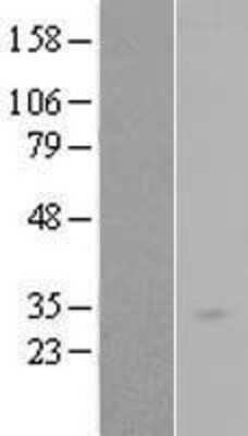 Western Blot: RAB34 Overexpression Lysate (Adult Normal) [NBL1-15063] Left-Empty vector transfected control cell lysate (HEK293 cell lysate); Right -Over-expression Lysate for RAB34.