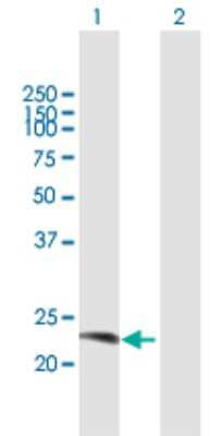 Western Blot: RAB38 Antibody [H00023682-B01P] - Analysis of RAB38 expression in transfected 293T cell line by RAB38 polyclonal antibody.  Lane 1: RAB38 transfected lysate(23.21 KDa). Lane 2: Non-transfected lysate.