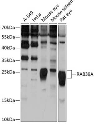 Western Blot RAB39 Antibody - Azide and BSA Free