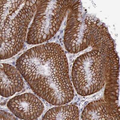 Immunohistochemistry-Paraffin RAB39B Antibody - BSA Free