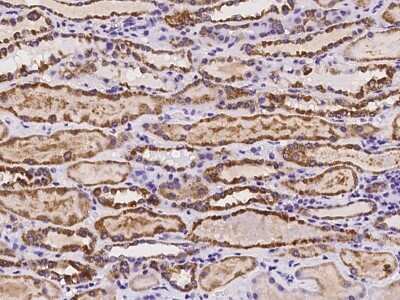Immunohistochemistry-Paraffin RAB39B Antibody - BSA Free