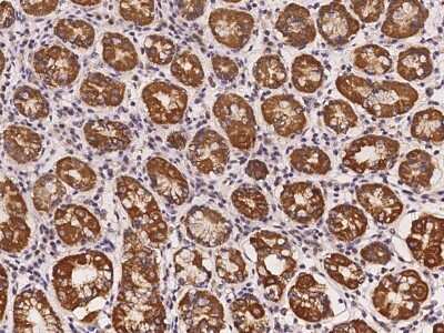 Immunohistochemistry-Paraffin RAB39B Antibody - BSA Free