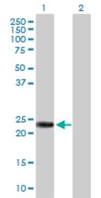 Western Blot: RAB39B Antibody [H00116442-D01P] - Analysis of RAB39B expression in transfected 293T cell line by RAB39B polyclonal antibody.Lane 1: RAB39B transfected lysate(24.60 KDa).Lane 2: Non-transfected lysate.