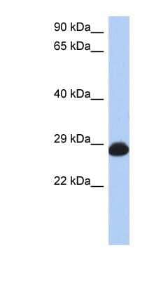 Western Blot: RAB39B Antibody [NBP1-58900] - Titration: 0.2-1 ug/ml, Positive Control: Human Stomach.