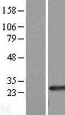 Western Blot RAB39B Overexpression Lysate