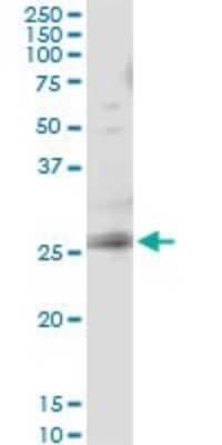 Immunoprecipitation: RAB3B Antibody (1A7) [H00005865-M02] - Analysis of RAB3B transfected lysate using anti-RAB3B monoclonal antibody and Protein A Magnetic Bead, and immunoblotted with RAB3B MaxPab rabbit polyclonal antibody.