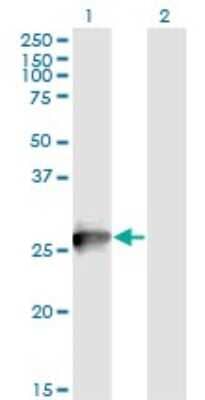 Western Blot RAB3B Antibody (1A7)