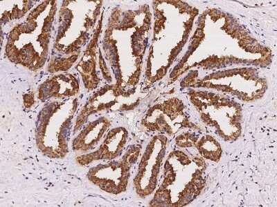 Immunohistochemistry-Paraffin: RAB3B Antibody [NBP2-97202] - Immunochemical staining of human RAB3B in human prostate with rabbit polyclonal antibody at 1:100 dilution, formalin-fixed paraffin embedded sections.