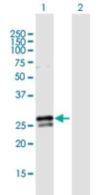 Western Blot: RAB3B Antibody [H00005865-B02P] - Analysis of RAB3B expression in transfected 293T cell line by RAB3B polyclonal antibody.  Lane 1: RAB3B transfected lysate(24.80 KDa). Lane 2: Non-transfected lysate.