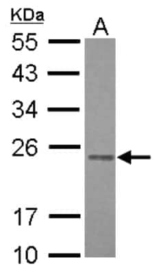 Western Blot RAB3B Antibody