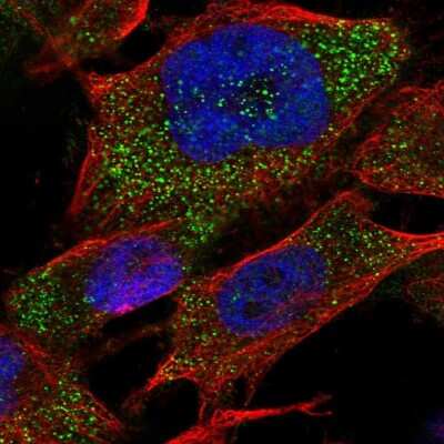 Immunocytochemistry/Immunofluorescence: RAB3GAP2 Antibody [NBP1-84199] - Staining of human cell line U-251 MG shows localization to cytosol. Antibody staining is shown in green.