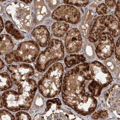 Immunohistochemistry-Paraffin: RAB3GAP2 Antibody [NBP1-84198] - Staining of human kidney shows strong cytoplasmic positivity in tubule cells.