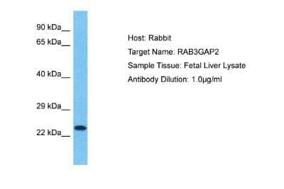 Western Blot: RAB3GAP2 Antibody [NBP2-85579] - Host: Rabbit. Target Name: RAB3GAP2. Sample Type: Fetal Liver lysates. Antibody Dilution: 1.0ug/ml