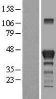 Western Blot RAB3IL1 Overexpression Lysate