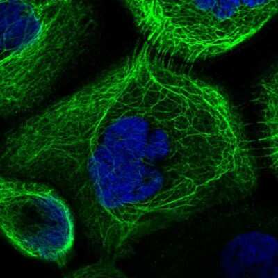 Immunocytochemistry/Immunofluorescence: RAB3IP Antibody [NBP1-92309] - Staining of human cell line A-431 shows localization to intermediate filaments. Antibody staining is shown in green.