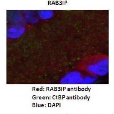 Immunohistochemistry: RAB3IP Antibody [NBP1-56744] - Dilution : 1: 200 Secondary Antibody : Goat anti-rabbit Alexafluor 568 Secondary Antibody Dilution : 1: 200 Color/Signal Descriptions : RAB3IP: Red CtBp: Green DAPI: Blue Gene Name : RAB3IP