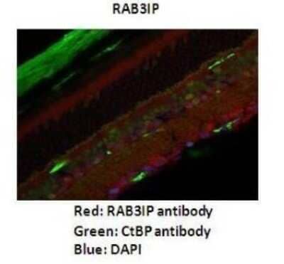 Immunohistochemistry: RAB3IP Antibody [NBP1-56744] - Dilution : 1: 200 Secondary Antibody : Goat anti-rabbit Alexafluor 568 Secondary Antibody Dilution : 1: 200 Color/Signal Descriptions : RAB3IP: Red CtBp: Green DAPI: Blue Gene Name : RAB3IP Submitted by : Anonymous