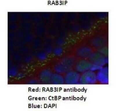 Immunohistochemistry: RAB3IP Antibody [NBP1-56744] - Dilution : 1: 200 Secondary Antibody : Goat anti-rabbit Alexafluor 568 Secondary Antibody Dilution : 1: 200 Color/Signal Descriptions : RAB3IP: Red CtBp: Green DAPI: Blue Gene Name : RAB3IP Submitted by : Anonymous