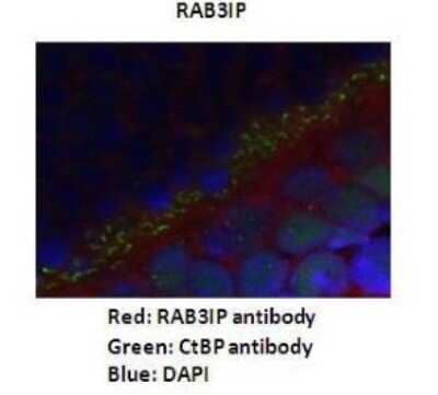 Immunohistochemistry: RAB3IP Antibody [NBP1-56744] - Dilution : 1: 200 Secondary Antibody : Goat anti-rabbit Alexafluor 568 Secondary Antibody Dilution : 1: 200 Color/Signal Descriptions : RAB3IP: Red CtBp: Green DAPI: Blue