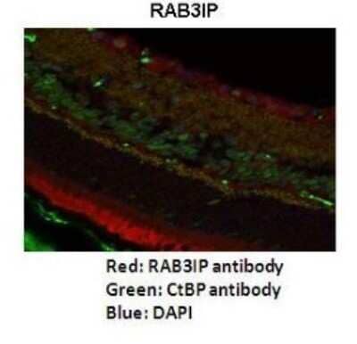 Immunohistochemistry: RAB3IP Antibody [NBP1-56745] - Mouse retina tissue Dilution: 1: 200 Secondary antibody: Goat anti-rabbit Alexafluor 568 Secondary antibody dilution: 1: 200 - See more at: