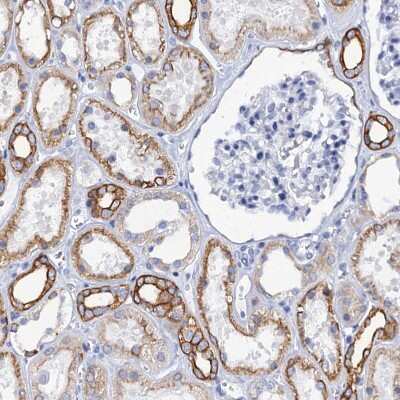 Immunohistochemistry-Paraffin: RAB3IP Antibody [NBP1-92309] - Staining of human kidney shows moderate membranous and cytoplasmic positivity in cells in tubules.