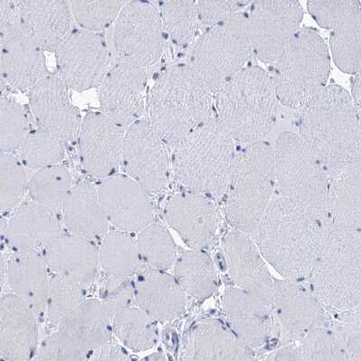 Immunohistochemistry-Paraffin: RAB3IP Antibody [NBP1-92309] - Staining of human skeletal muscle shows no positivity in myocytes as expected.