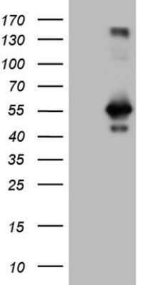 Western Blot: RAB3IP Antibody (OTI5F2) - Azide and BSA Free [NBP2-73775] - HEK293T cells were transfected with the pCMV6-ENTRY control (Left lane) or pCMV6-ENTRY RAB3IP .