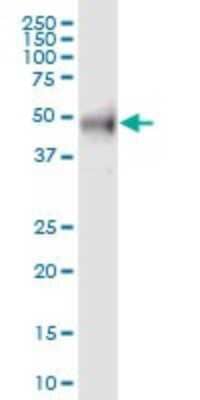 Western Blot: RAB3IP Antibody [H00117177-B01P] - Analysis of RAB3IP expression in human placenta.