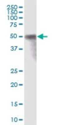 Western Blot: RAB3IP Antibody [H00117177-B01P] - Analysis of RAB3IP expression in rat brain.