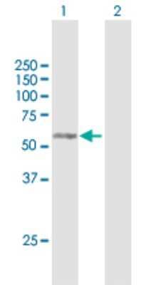 Western Blot: RAB3IP Antibody [H00117177-B01P] - Analysis of RAB3IP expression in transfected 293T cell line by RAB3IP polyclonal antibody.  Lane 1: RAB3IP transfected lysate(50.6 KDa). Lane 2: Non-transfected lysate.