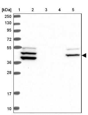 Western Blot: RAB3IP Antibody [NBP1-92309] - Lane 1: Marker  [kDa] 250, 130, 95, 72, 55, 36, 28, 17, 10.  Lane 2: Human cell line RT-4.  Lane 3: Human cell line U-251MG sp.  Lane 4: Human plasma (IgG/HSA depleted).  Lane 5: Human liver tissue