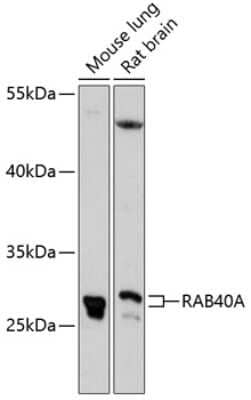 Western Blot: RAB40A Antibody [NBP2-93889] - Analysis of extracts of various cell lines, using RAB40A . Exposure time: 90s.