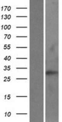 Western Blot: RAB40C Overexpression Lysate (Adult Normal) [NBP2-06552] Left-Empty vector transfected control cell lysate (HEK293 cell lysate); Right -Over-expression Lysate for RAB40C.