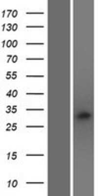 Western Blot: RAB40C Overexpression Lysate (Adult Normal) [NBP2-10245] Left-Empty vector transfected control cell lysate (HEK293 cell lysate); Right -Over-expression Lysate for RAB40C.