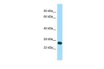 Western Blot: RAB41 Antibody [NBP2-83435] - WB Suggested Anti-RAB41 Antibody. Titration: 1.0 ug/ml. Positive Control: MCF7 Whole Cell