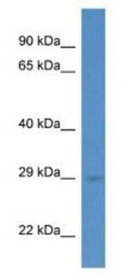 Western Blot: RAB5C Antibody [NBP1-74182] - Mouse Pancreas lysate, concentration 1 ug/ml.